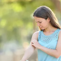 Woman scratching at mosquito bite on arm