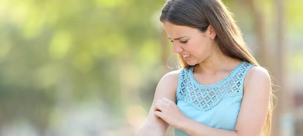 Woman scratching at mosquito bite on arm